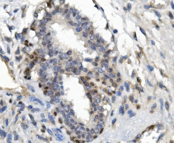 FOXP1 Antibody