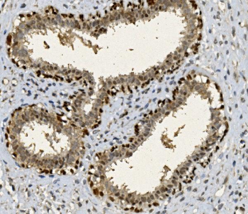 FOXP1 Antibody