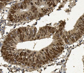 FOXP1 Antibody