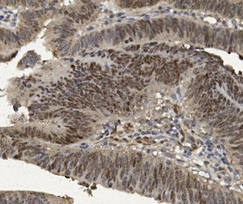 FOXP1 Antibody
