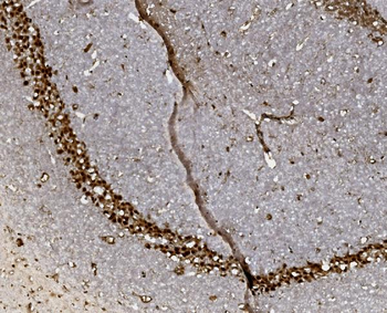 FOXP1 Antibody