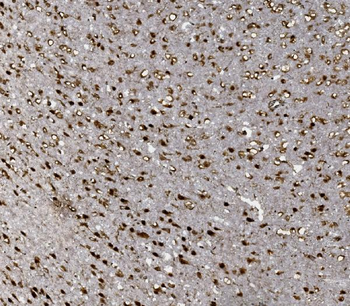 FOXP1 Antibody