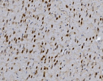 FOXP1 Antibody