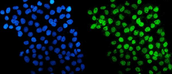 HDAC5 Antibody