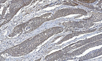 HDAC5 Antibody