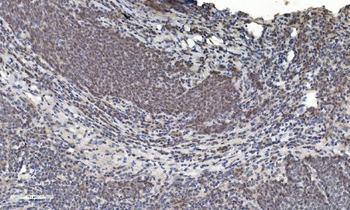 HDAC5 Antibody