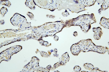 HDAC5 Antibody