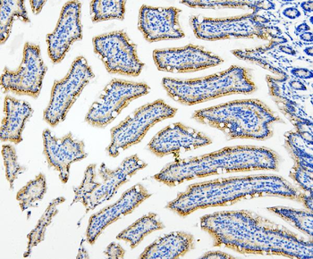 HDAC5 Antibody