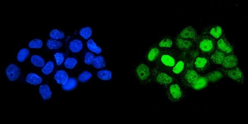 HOXD11 Antibody