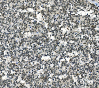 HOXD11 Antibody