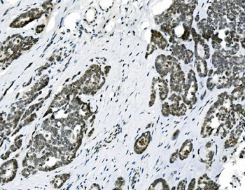 HOXD11 Antibody