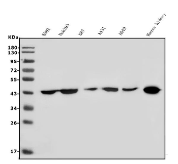 HOXD11 Antibody
