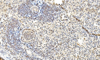 LSM2 Antibody