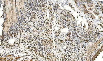 LSM2 Antibody