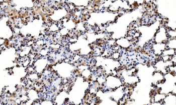 LSM2 Antibody