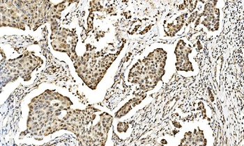 LSM2 Antibody