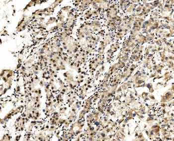 LSM2 Antibody