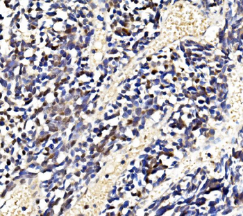 LSM2 Antibody