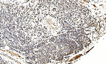 LSM2 Antibody