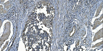 MCU Rabbit Polyclonal Antibody