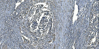 MCU Rabbit Polyclonal Antibody