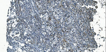 MCU Rabbit Polyclonal Antibody