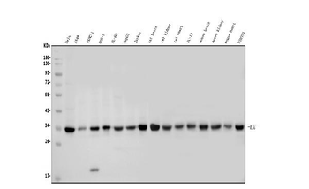 MCU Rabbit Polyclonal Antibody