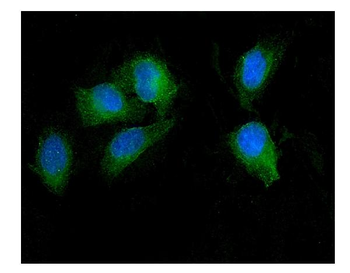 SEZ6L Rabbit Polyclonal Antibody