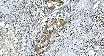 DR6/TNFRSF21 Antibody