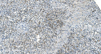 DR6/TNFRSF21 Antibody