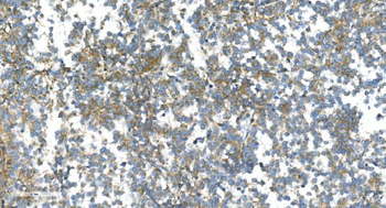 DR6/TNFRSF21 Antibody