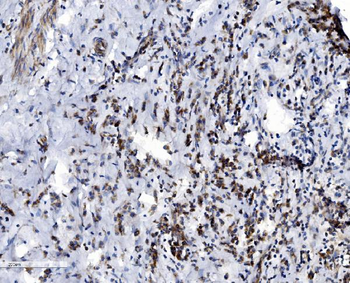 VDAC3 Antibody