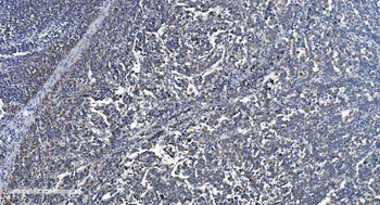VDAC3 Antibody