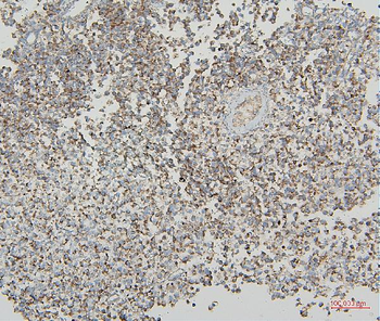 VDAC3 Antibody