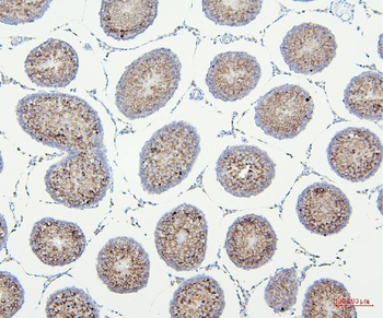 VDAC3 Antibody