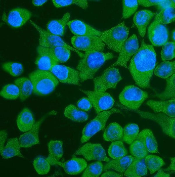 YTHDF2 Antibody