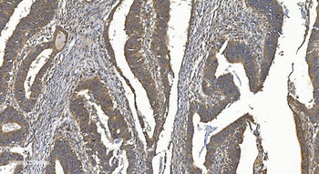 YTHDF2 Antibody