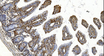 YTHDF2 Antibody