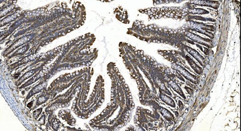YTHDF2 Antibody