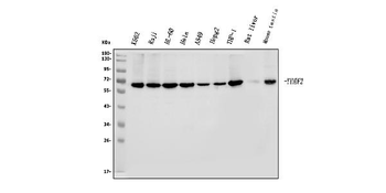 YTHDF2 Antibody