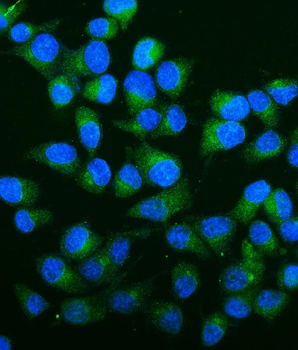 Carbonic Anhydrase 13/CA13 Rabbit Polyclonal Antibody