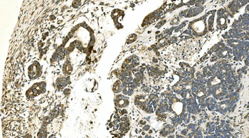 Carbonic Anhydrase 13/CA13 Rabbit Polyclonal Antibody