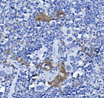CD72 Rabbit Polyclonal Antibody