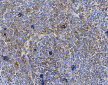 CD72 Rabbit Polyclonal Antibody