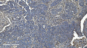 LOC134147/CMBL Rabbit Polyclonal Antibody