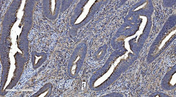 LOC134147/CMBL Rabbit Polyclonal Antibody