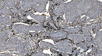 LOC134147/CMBL Rabbit Polyclonal Antibody