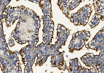 MUC1 Rabbit Polyclonal Antibody