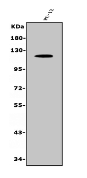 MUC1 Rabbit Polyclonal Antibody
