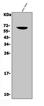 CD16/Fcgr3 Rabbit Polyclonal Antibody